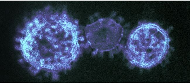 Colorized transmission electron micrograph showing particles of the Middle East respiratory syndrome coronavirus that emerged in 2012. Credit: NIAID